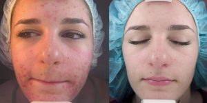 Kozmetik Tedaviler Kozmetik Tedaviler